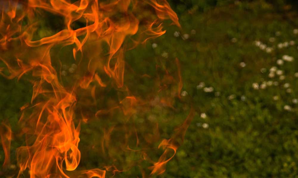 fire and burn injuries
